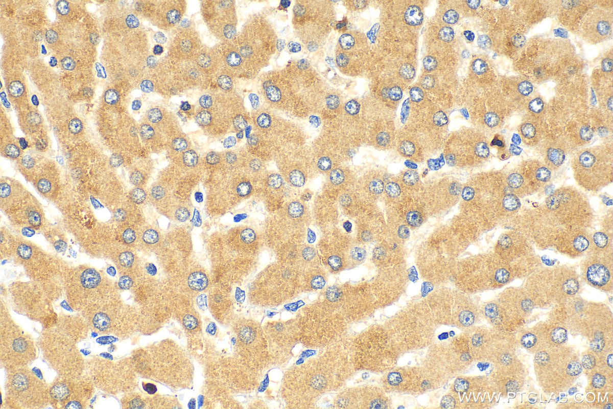 Immunohistochemistry (IHC) staining of human liver tissue using MMP13 Polyclonal antibody (18165-1-AP)