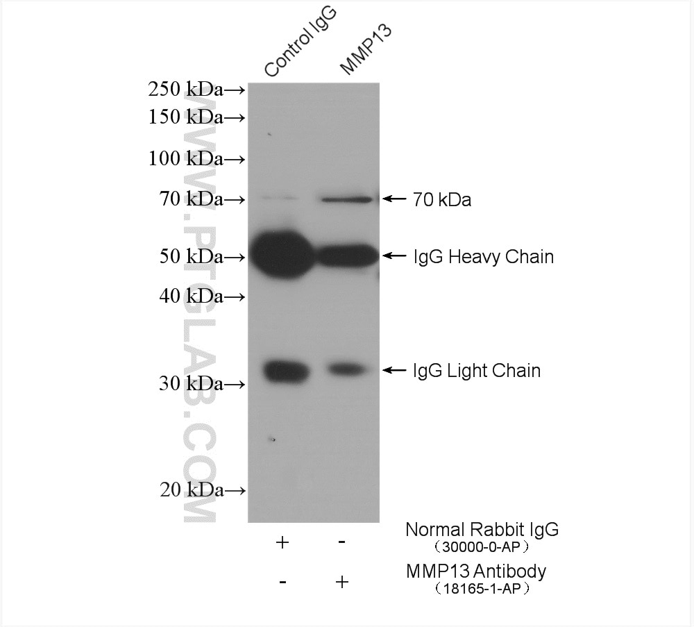 Immunoprecipitation (IP) experiment of MCF-7 cells using MMP13 Polyclonal antibody (18165-1-AP)