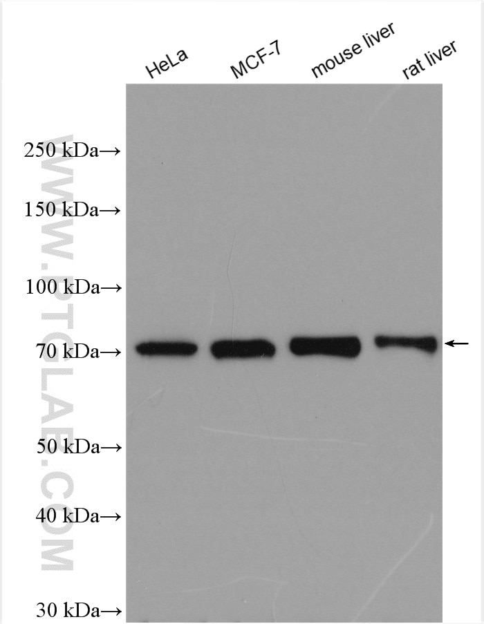 Western Blot (WB) analysis of various lysates using MMP13 Polyclonal antibody (18165-1-AP)