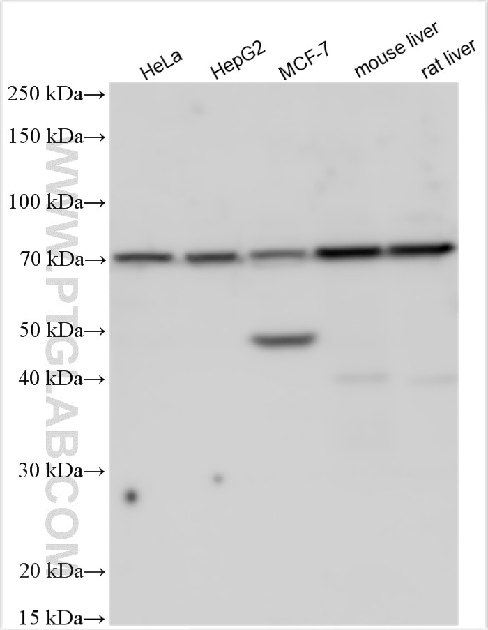 Western Blot (WB) analysis of various lysates using MMP13 Polyclonal antibody (18165-1-AP)
