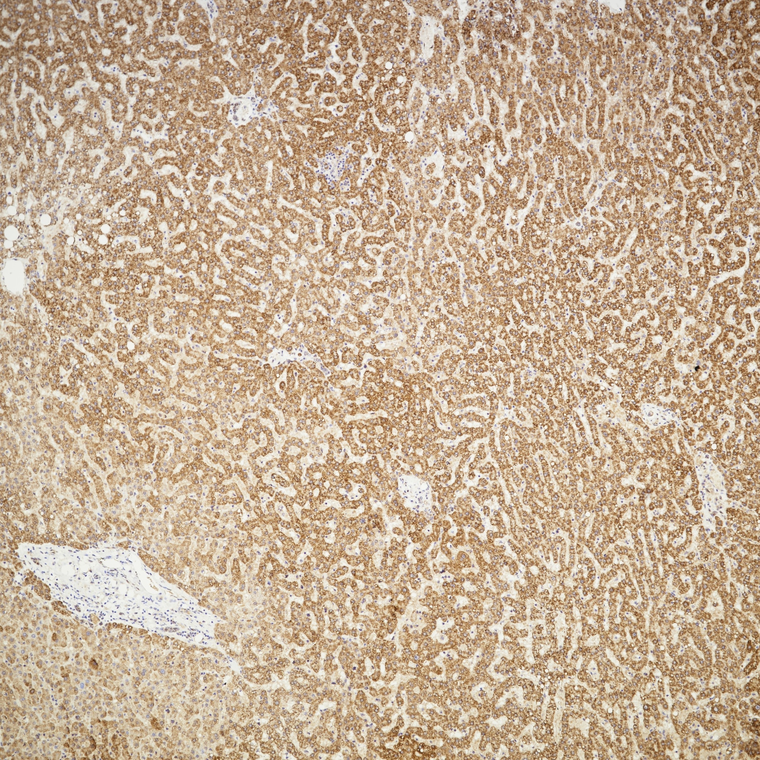 IHC staining of human liver using 83188-4-RR Immunohistochemistry (IHC) staining of human liver tissue using MMP13 Recombinant monoclonal antibody (83188-4-RR)