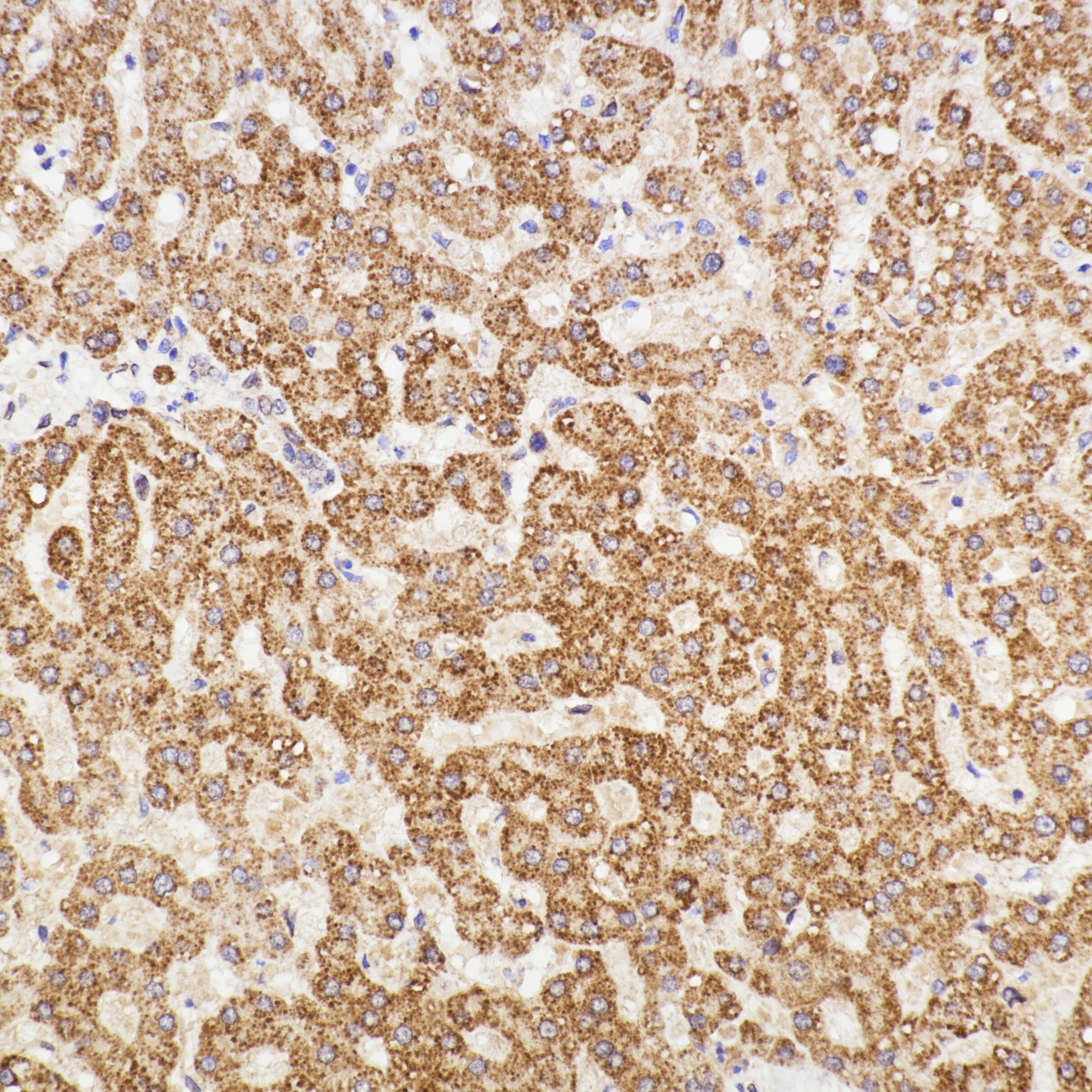 IHC staining of human liver using 83188-4-RR Immunohistochemistry (IHC) staining of human liver tissue using MMP13 Recombinant monoclonal antibody (83188-4-RR)
