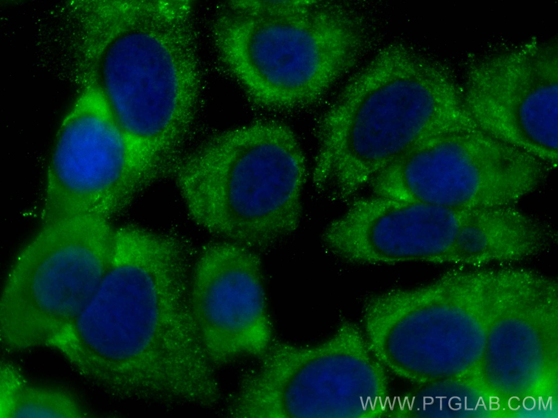 Immunofluorescence (IF) / fluorescent staining of MCF-7 cells using CoraLite® Plus 488-conjugated MMP13 Polyclonal ant (CL488-18165)