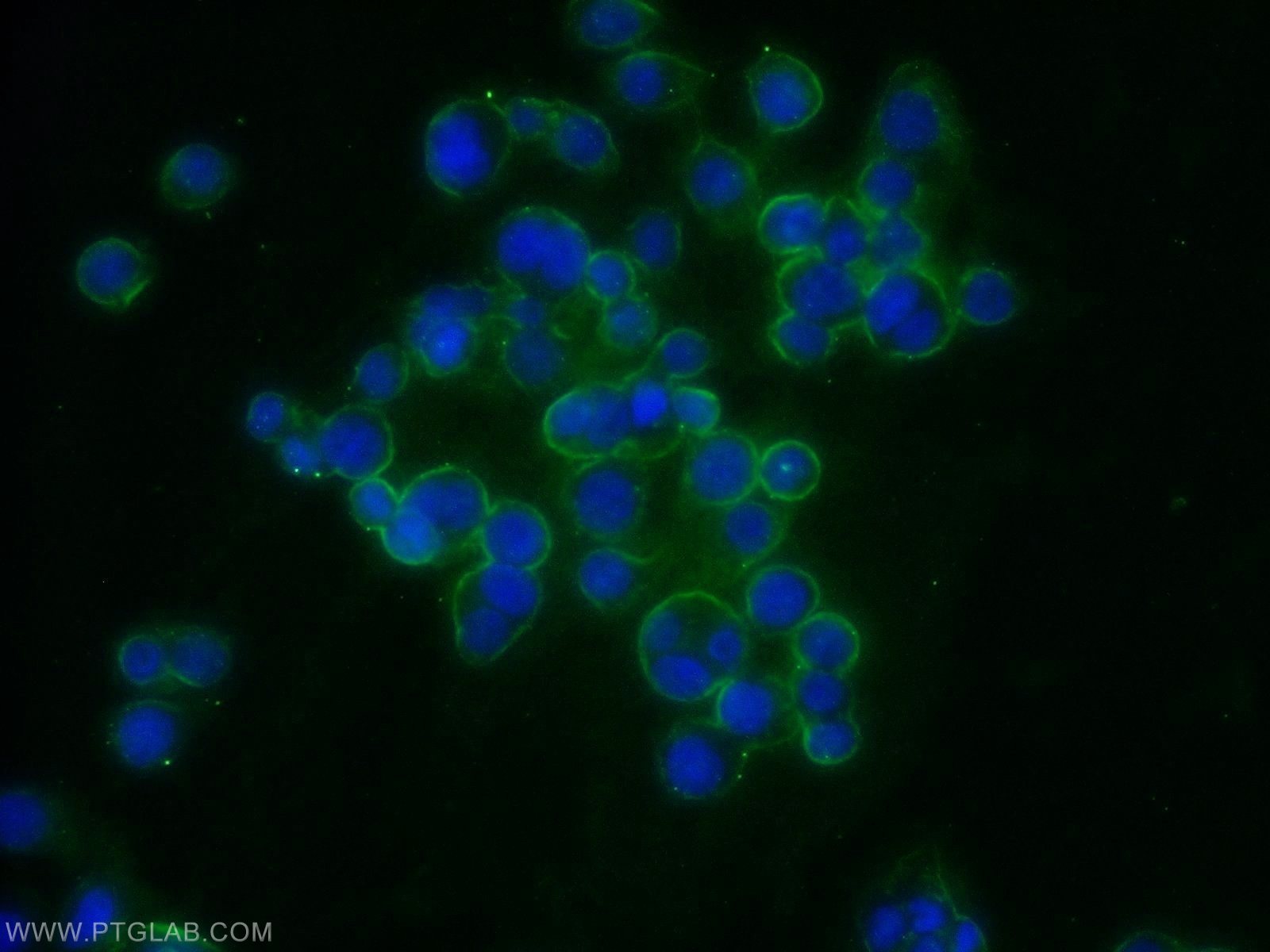 Immunofluorescence (IF) / fluorescent staining of COLO 320 cells using MMP14 / MT1-MMP Polyclonal antibody (14552-1-AP)
