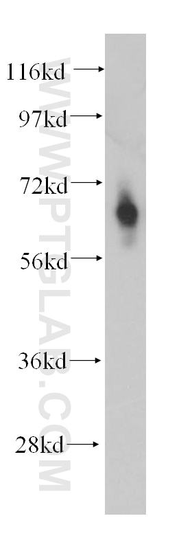 Western Blot (WB) analysis of human colon tissue using MMP14 / MT1-MMP Polyclonal antibody (14552-1-AP)
