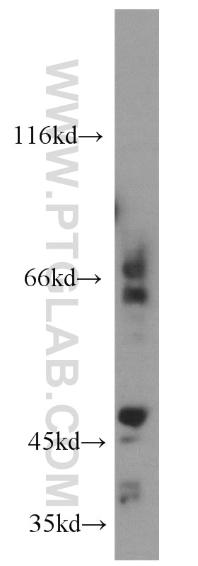 Western Blot (WB) analysis of HepG2 cells using MMP14 / MT1-MMP Polyclonal antibody (14552-1-AP)