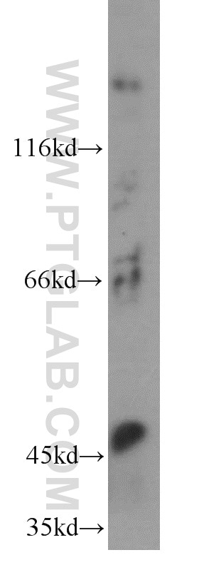 Western Blot (WB) analysis of A549 cells using MMP14 / MT1-MMP Polyclonal antibody (14552-1-AP)