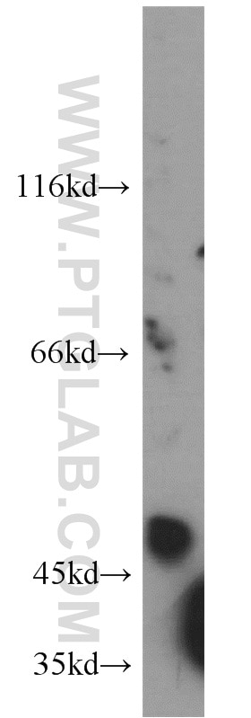 Western Blot (WB) analysis of COLO 320 cells using MMP14 / MT1-MMP Polyclonal antibody (14552-1-AP)