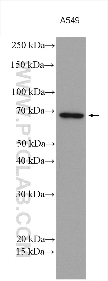 Western Blot (WB) analysis of various lysates using MMP14 / MT1-MMP Polyclonal antibody (29111-1-AP)