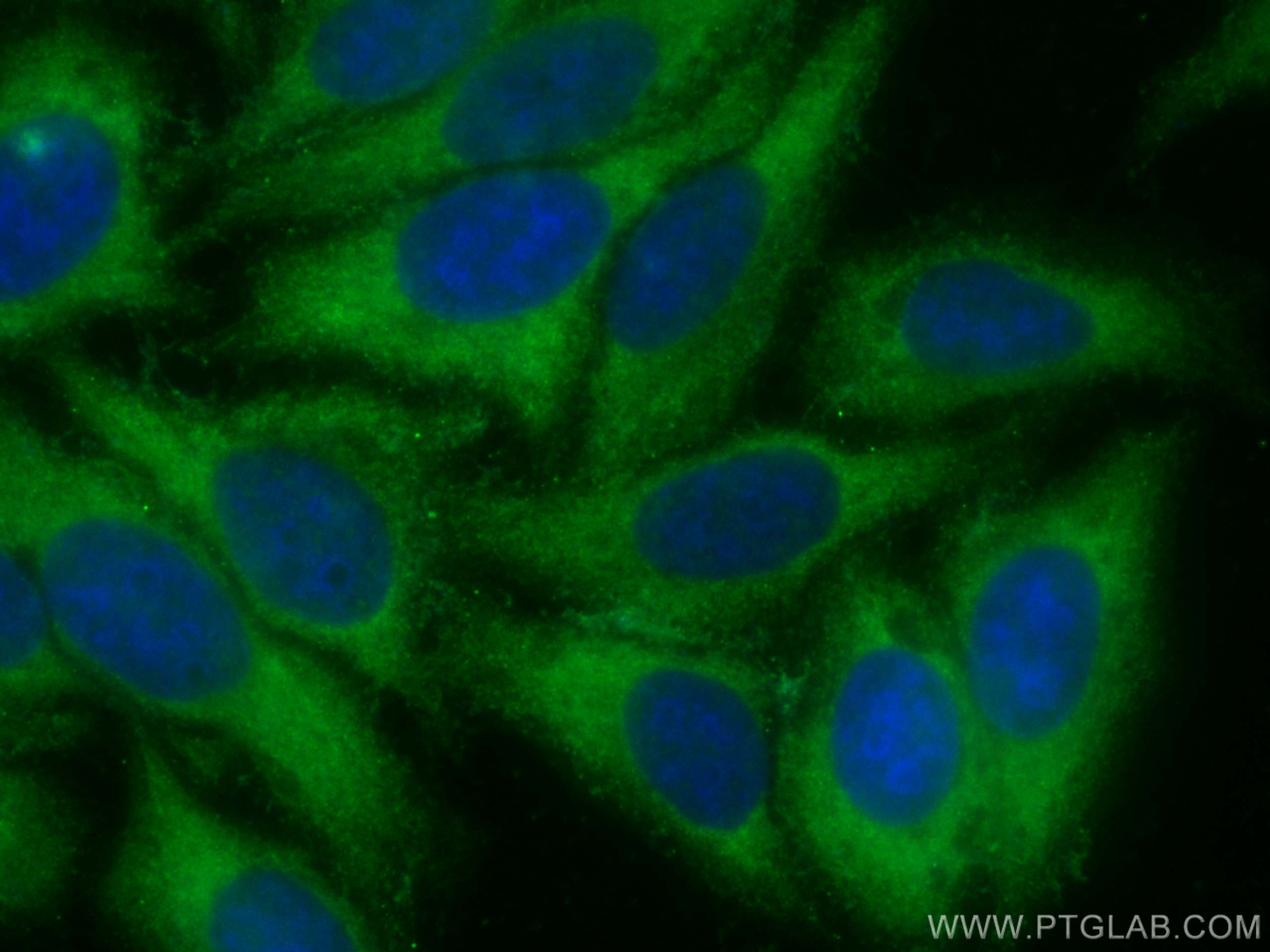Immunofluorescence (IF) / fluorescent staining of HepG2 cells using CoraLite® Plus 488-conjugated MMP14 / MT1-MMP Poly (CL488-14552)