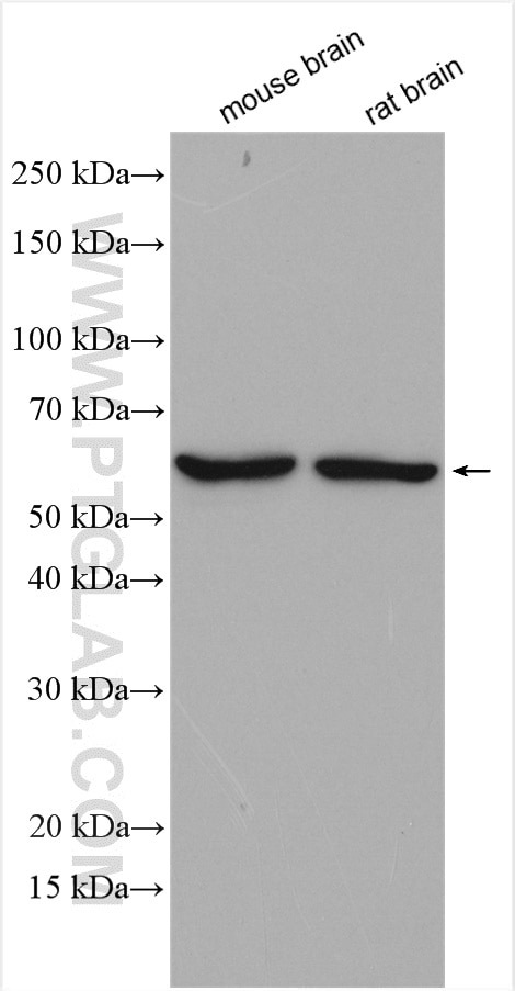 Western Blot (WB) analysis of various lysates using MMP17 Polyclonal antibody (28429-1-AP)