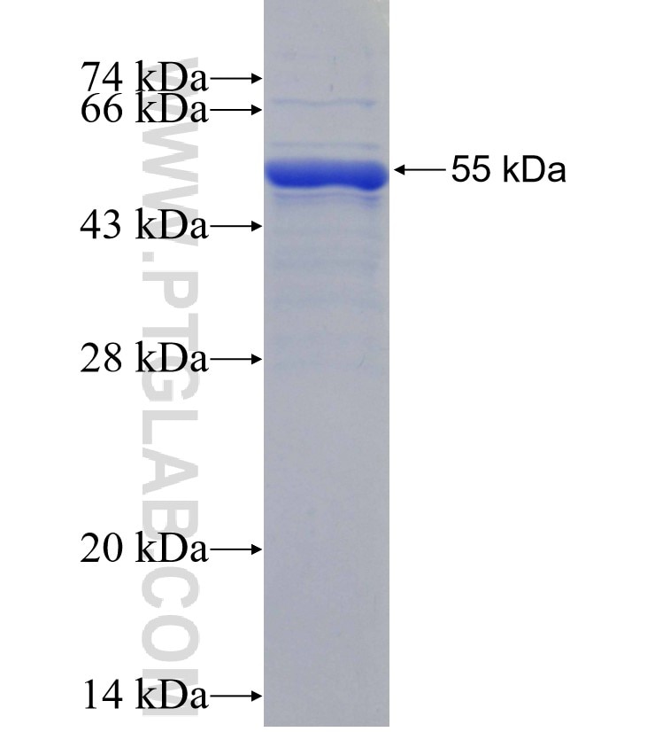 MMP17 fusion protein Ag29298 SDS-PAGE