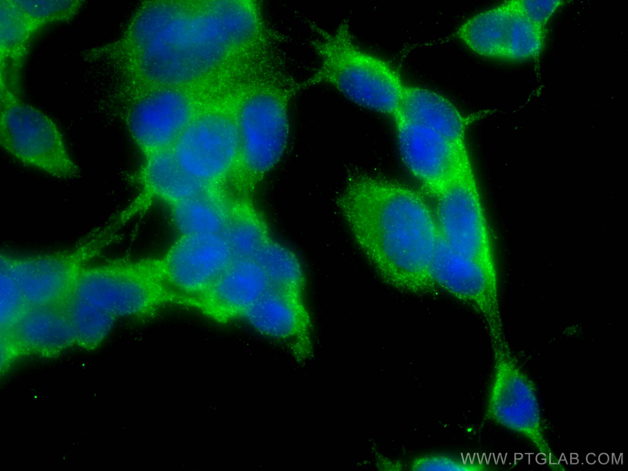 Immunofluorescence (IF) / fluorescent staining of SH-SY5Y cells using MMP19 Polyclonal antibody (14244-1-AP)
