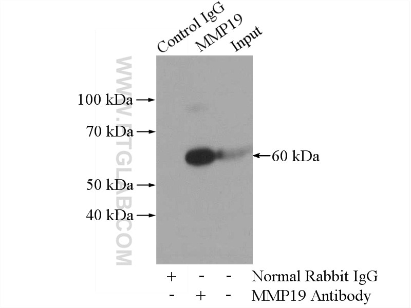 Immunoprecipitation (IP) experiment of human placenta tissue using MMP19 Polyclonal antibody (14244-1-AP)