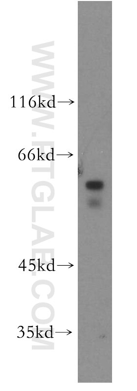 Western Blot (WB) analysis of SH-SY5Y cells using MMP19 Polyclonal antibody (14244-1-AP)