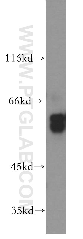 Western Blot (WB) analysis of human placenta tissue using MMP19 Polyclonal antibody (14244-1-AP)