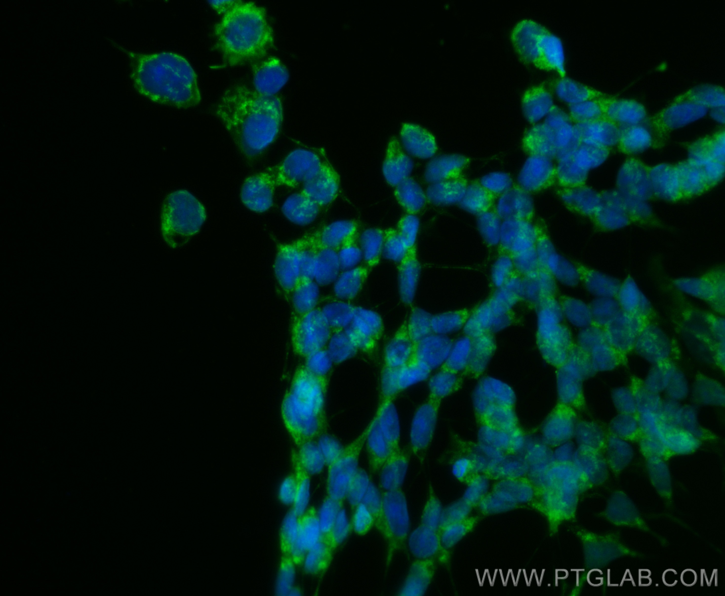 Immunofluorescence (IF) / fluorescent staining of SH-SY5Y cells using CoraLite® Plus 488-conjugated MMP19 Polyclonal ant (CL488-14244)