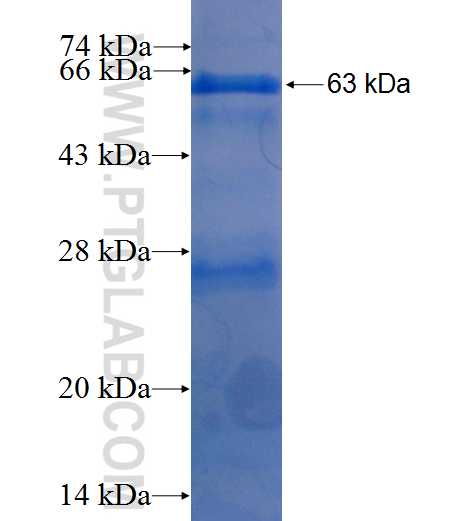 MMP19 fusion protein Ag5501 SDS-PAGE