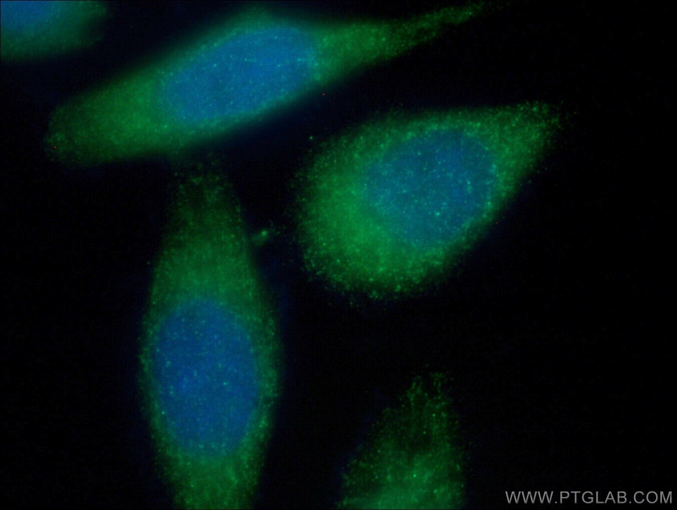 IF Staining of HepG2 using 10373-2-AP