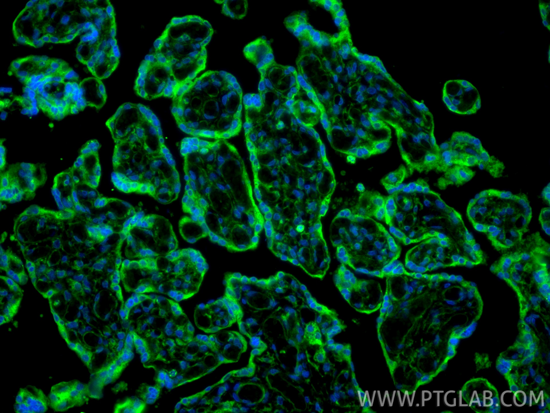 Immunofluorescence (IF) / fluorescent staining of human placenta tissue using MMP2 Polyclonal antibody (10373-2-AP)