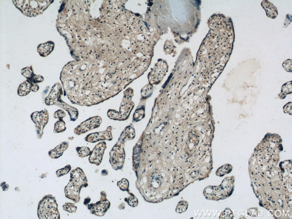 IHC staining of human placenta using 10373-2-AP