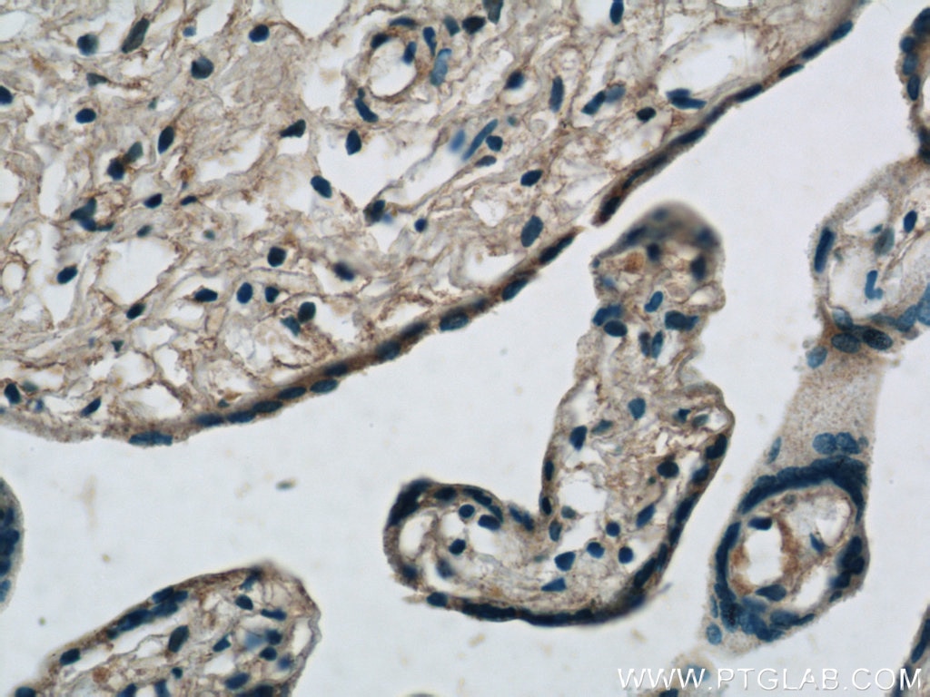 Immunohistochemistry (IHC) staining of human placenta tissue using MMP2 Polyclonal antibody (10373-2-AP)