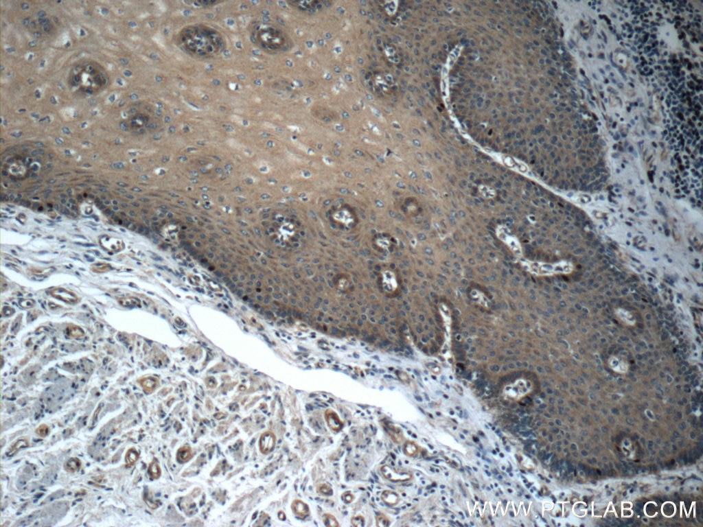 Immunohistochemistry (IHC) staining of human oesophagus tissue using MMP2 Polyclonal antibody (10373-2-AP)