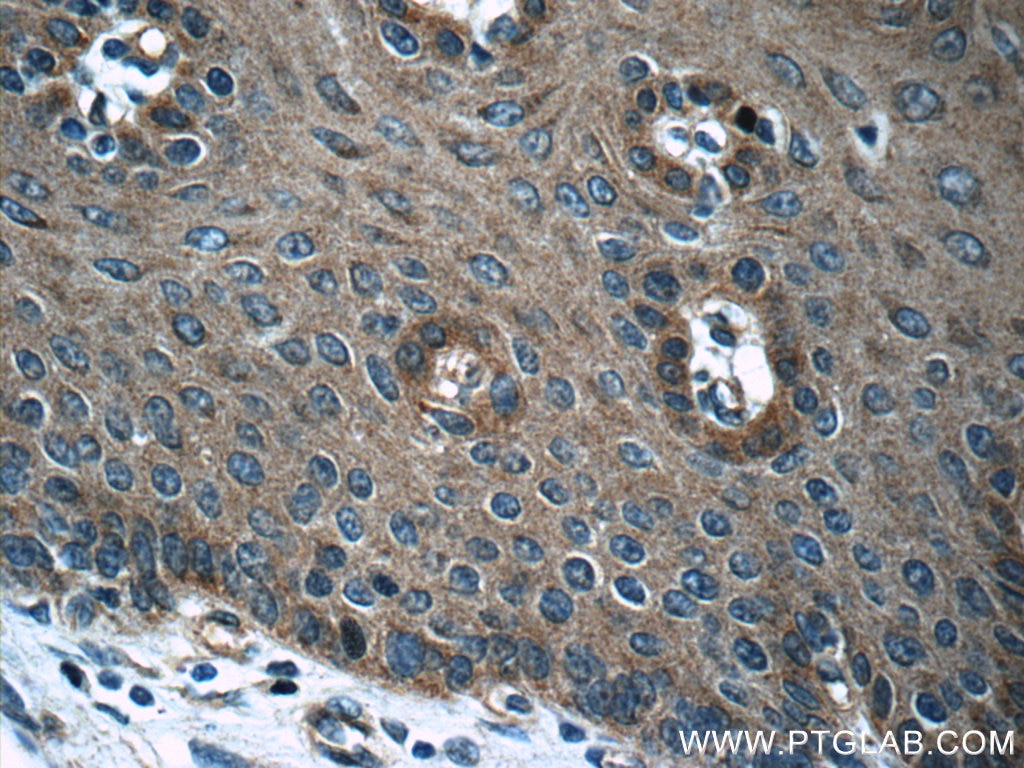 Immunohistochemistry (IHC) staining of human oesophagus tissue using MMP2 Polyclonal antibody (10373-2-AP)