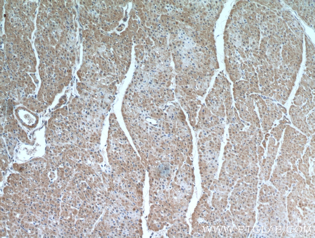 IHC staining of human heart using 10373-2-AP
