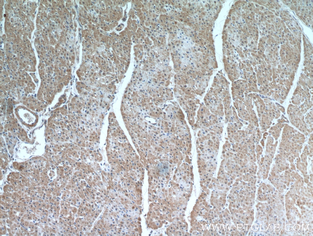 Immunohistochemistry (IHC) staining of human heart tissue using MMP2 Polyclonal antibody (10373-2-AP)