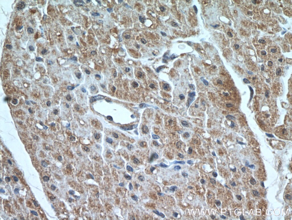 Immunohistochemistry (IHC) staining of human heart tissue using MMP2 Polyclonal antibody (10373-2-AP)