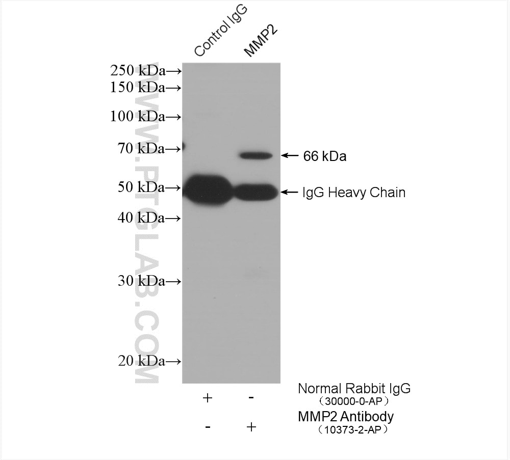 Immunoprecipitation (IP) experiment of MCF-7 cells using MMP2 Polyclonal antibody (10373-2-AP)