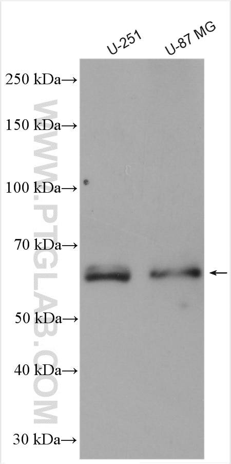 Western Blot (WB) analysis of various lysates using MMP2 Polyclonal antibody (10373-2-AP)