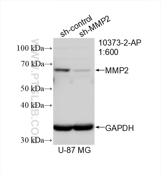 Western Blot (WB) analysis of U-87 MG cells using MMP2 Polyclonal antibody (10373-2-AP)