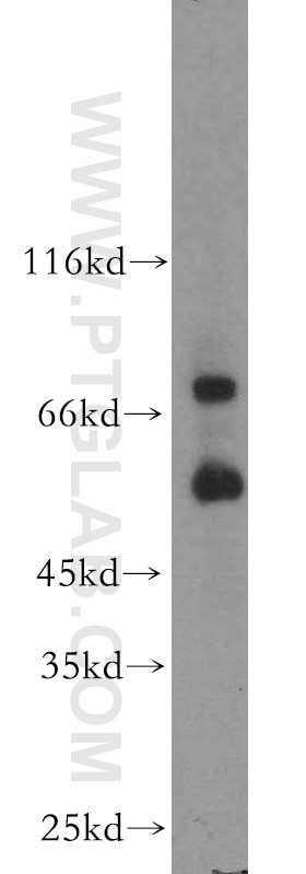 MMP2 Polyclonal antibody