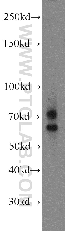 Western Blot (WB) analysis of MCF-7 cells using MMP2 Polyclonal antibody (10373-2-AP)