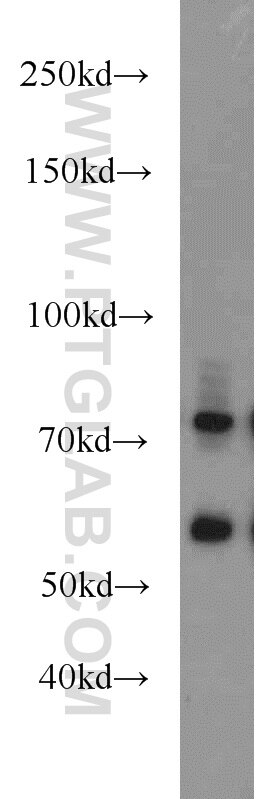 Western Blot (WB) analysis of HepG2 cells using MMP2 Polyclonal antibody (10373-2-AP)