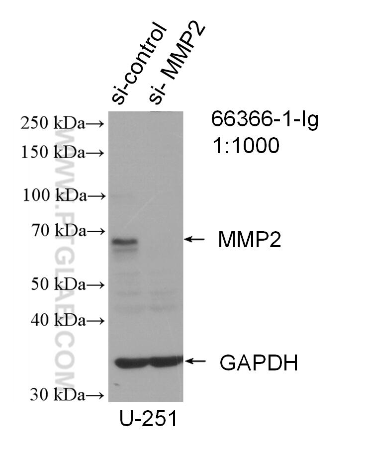 Western Blot (WB) analysis of U-251 cells using MMP2 Monoclonal antibody (66366-1-Ig)
