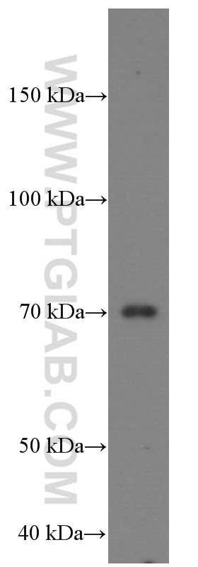 Western Blot (WB) analysis of human placenta tissue using MMP2 Monoclonal antibody (66366-1-Ig)