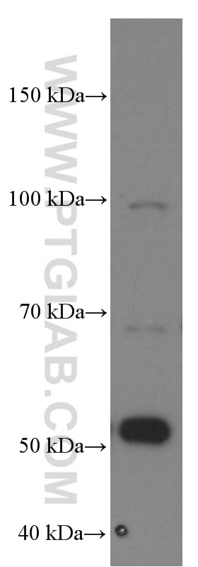 Western Blot (WB) analysis of pig heart tissue using MMP2 Monoclonal antibody (66366-1-Ig)