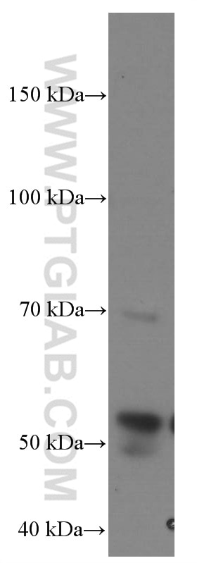 Western Blot (WB) analysis of rat heart tissue using MMP2 Monoclonal antibody (66366-1-Ig)
