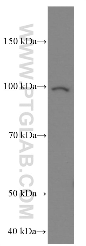 Western Blot (WB) analysis of human heart tissue using MMP2 Monoclonal antibody (66366-1-Ig)