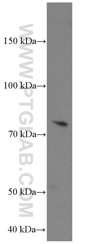 Western Blot (WB) analysis of MCF-7 cells using MMP2 Monoclonal antibody (66366-1-Ig)