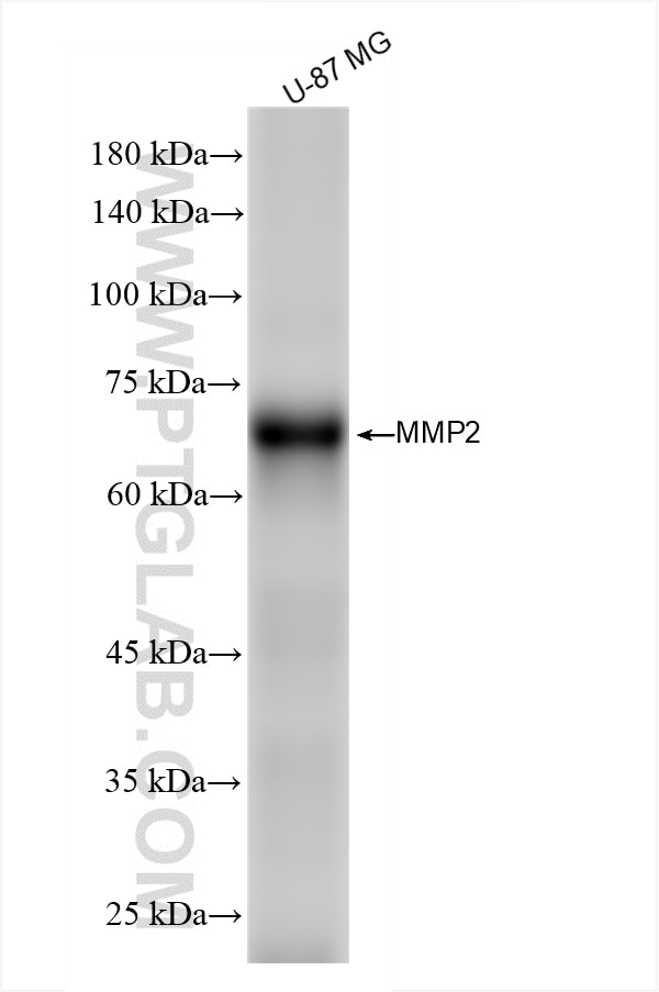 Western Blot (WB) analysis of U-87 MG cells using MMP2 Recombinant antibody (81515-5-RR)
