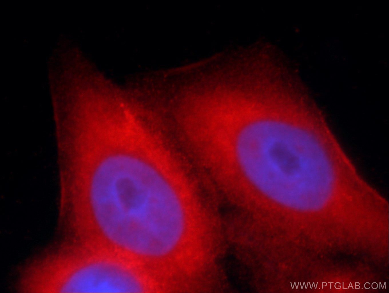 Immunofluorescence (IF) / fluorescent staining of HeLa cells using MMP20 Polyclonal antibody (55467-1-AP)