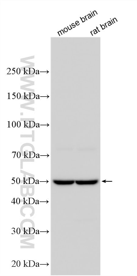 Various lysates were subjected to SDS PAGE followed by western blot with 55467-1-AP (MMP20 antibody) at dilution of 1:2000 incubated at room temperature for 1.5 hours. Western Blot (WB) analysis of various lysates using MMP20 Polyclonal antibody (55467-1-AP)