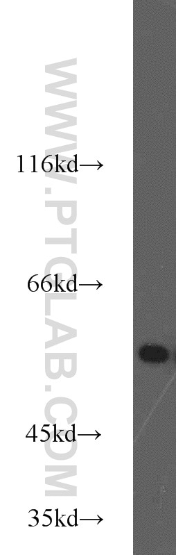 Western Blot (WB) analysis of rat brain tissue using MMP20 Polyclonal antibody (55467-1-AP)