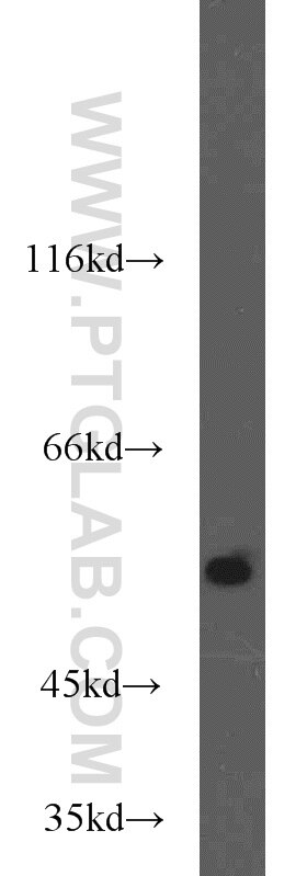 Western Blot (WB) analysis of rat brain tissue using MMP20 Polyclonal antibody (55467-1-AP)