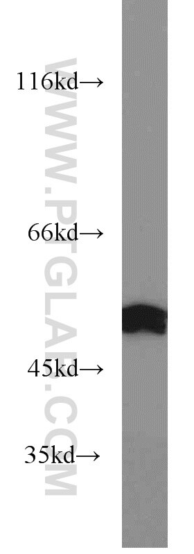 Western Blot (WB) analysis of rat brain tissue using MMP20 Polyclonal antibody (55467-1-AP)