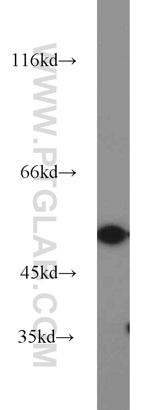 Western Blot (WB) analysis of rat brain tissue using MMP20 Polyclonal antibody (55467-1-AP)